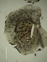 /album/fotogaleria-medium-spiny-neuron-labeled-with-dii-and-genegun/olli-brain-golgi-5-jpg/